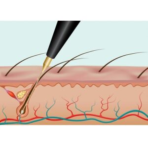 electroysis illustration 1024x724 4